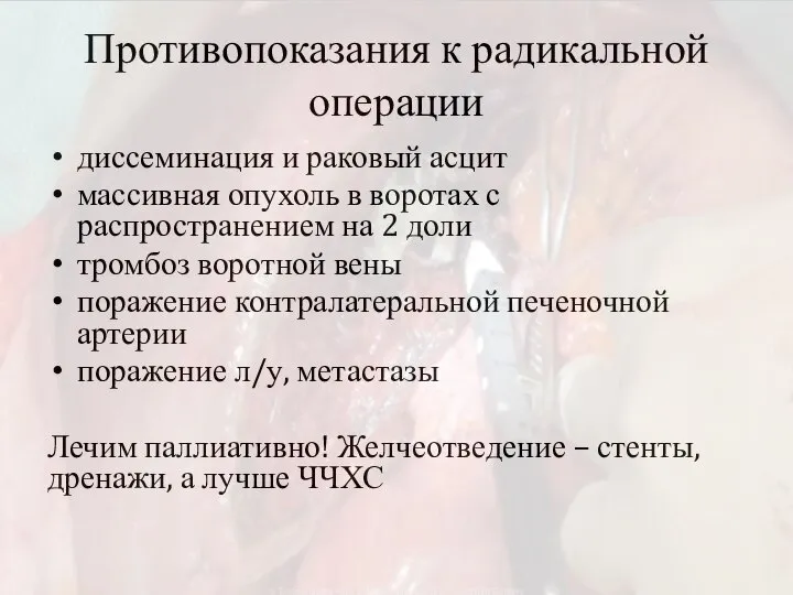 Противопоказания к радикальной операции диссеминация и раковый асцит массивная опухоль в воротах