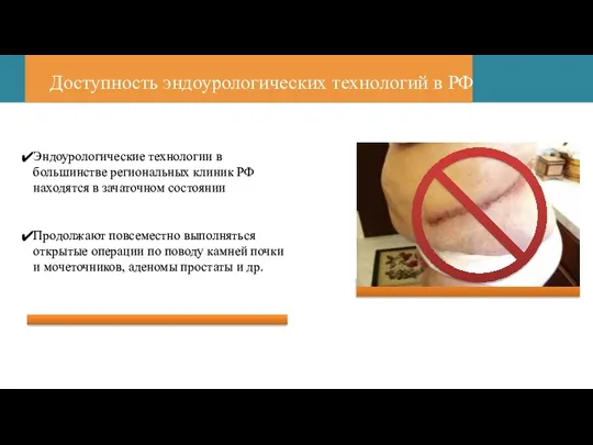 Доступность эндоурологических технологий в РФ Эндоурологические технологии в большинстве региональных клиник РФ