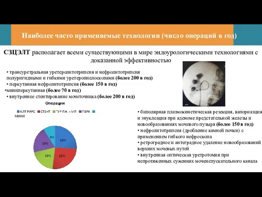 Наиболее часто применяемые технологии (число операций в год) • трансуретральная уретеролитотрипсия и