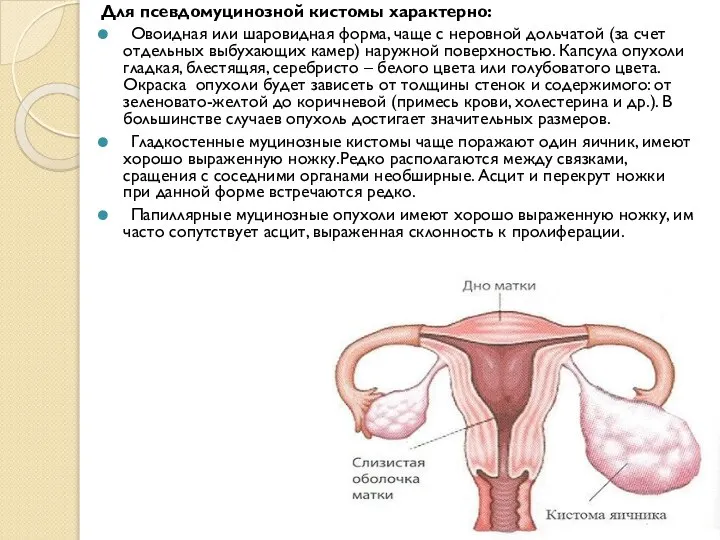 Для псевдомуцинозной кистомы характерно: Овоидная или шаровидная форма, чаще с неровной дольчатой