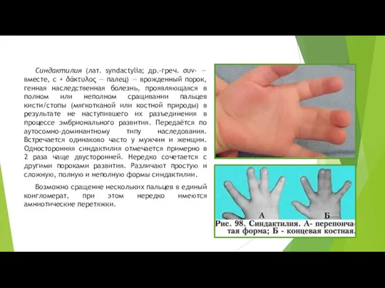 Синдактилия (лат. syndactylia; др.-греч. συν- — вместе, с + δάκτυλος — палец)