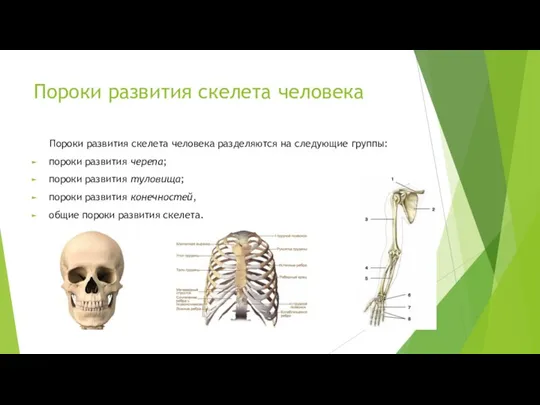Пороки развития скелета человека Пороки развития скелета человека разделяются на следующие группы: