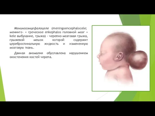 Менингоэнцефалоцеле (meningoencephalocele; менинго- + греческое enkephalos головной мозг + kele выбухание, грыжа)