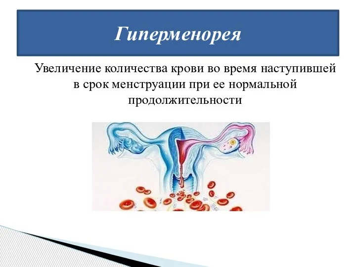 Увеличение количества крови во время наступившей в срок менструации при ее нормальной продолжительности Гиперменорея