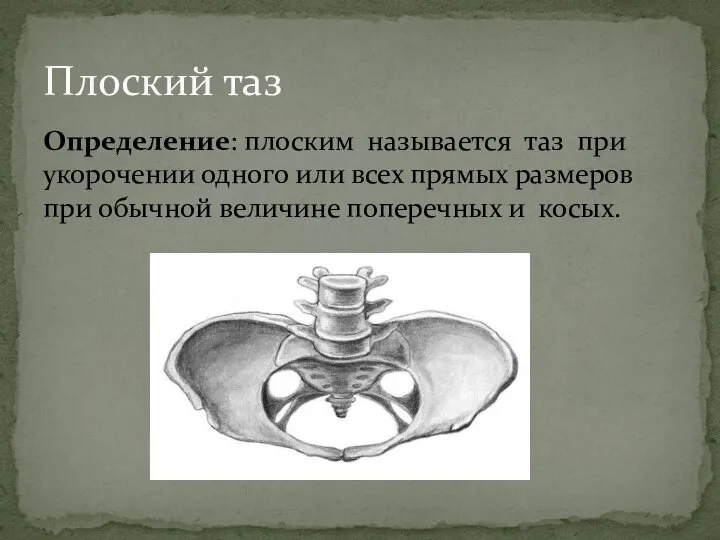 Определение: плоским называется таз при укорочении одного или всех прямых размеров при