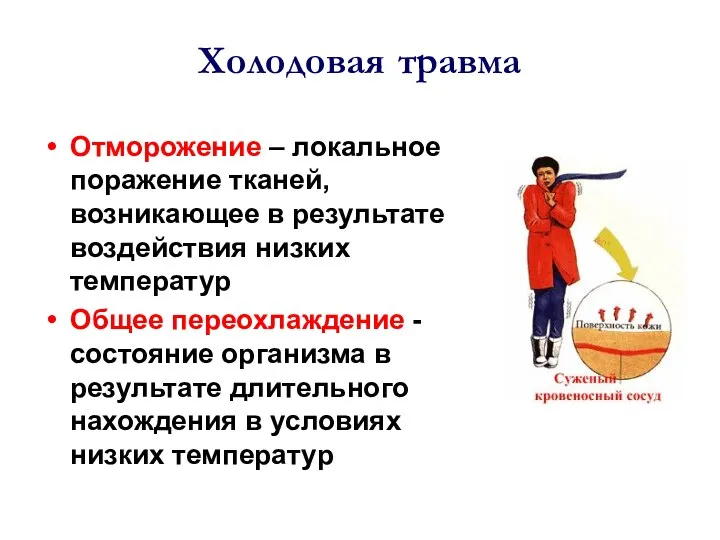 Холодовая травма Отморожение – локальное поражение тканей, возникающее в результате воздействия низких