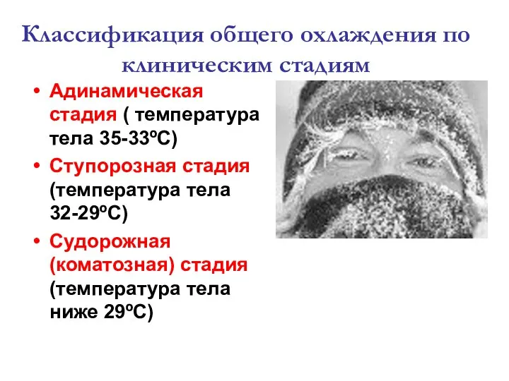 Классификация общего охлаждения по клиническим стадиям Адинамическая стадия ( температура тела 35-33ºС)