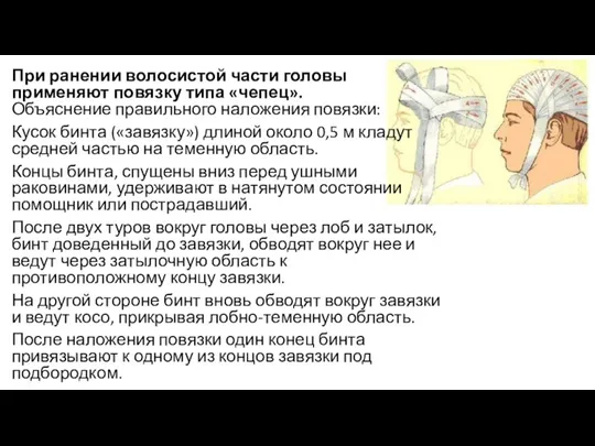 При ранении волосистой части головы применяют повязку типа «чепец». Объяснение правильного наложения