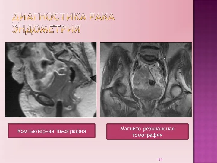 Компьютерная томография Магнито-резонансная томография