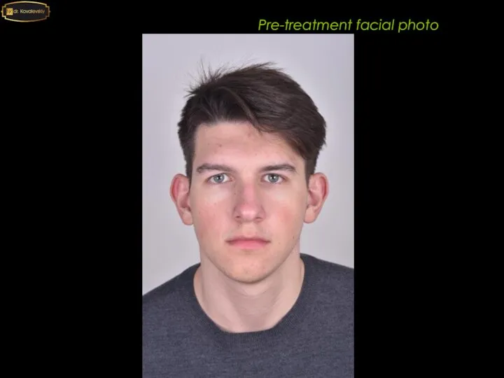 Pre-treatment facial photo