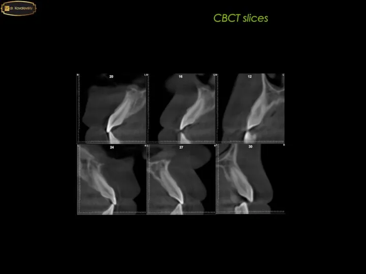 2020 CBCT slices