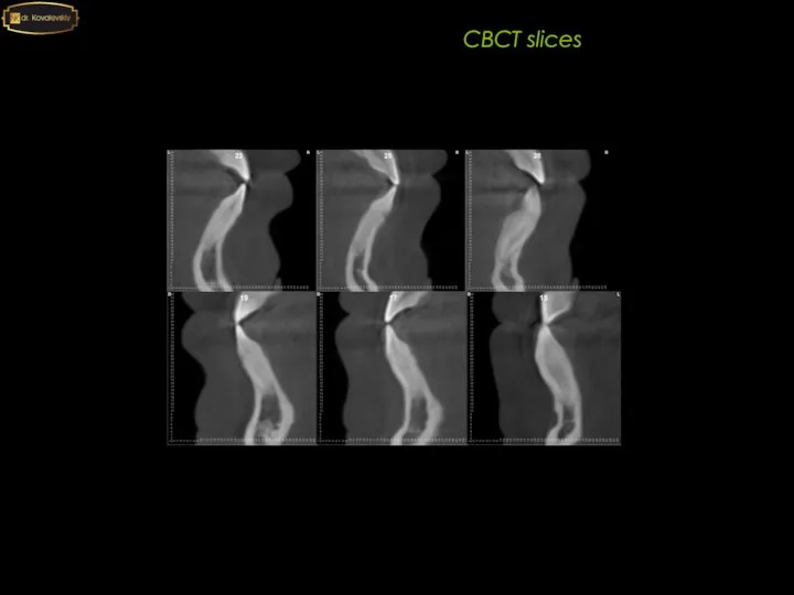 2020 CBCT slices