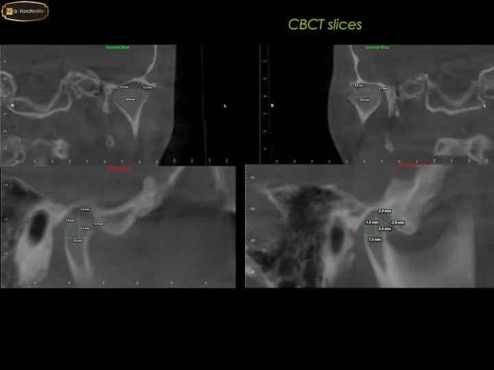 CBCT slices