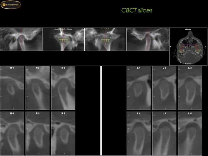 4-4 6-6 CBCT slices