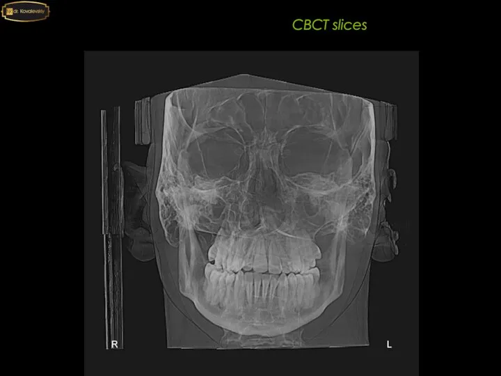 4-4 6-6 CBCT slices