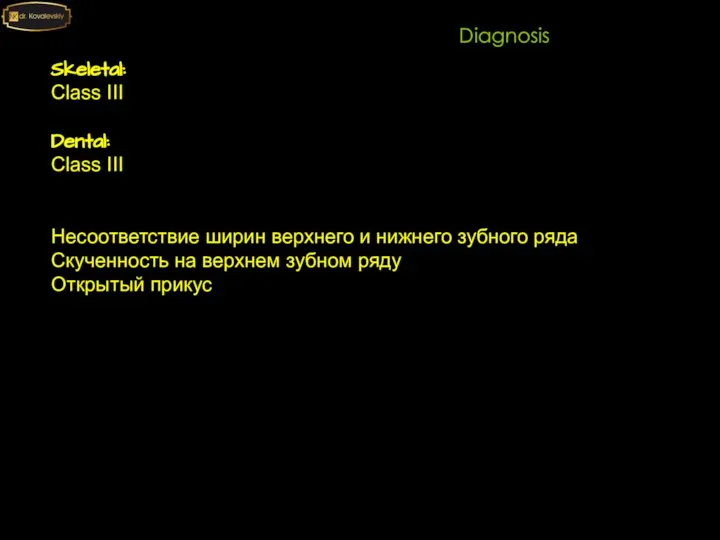 Skeletal: Class III Dental: Class III Несоответствие ширин верхнего и нижнего зубного