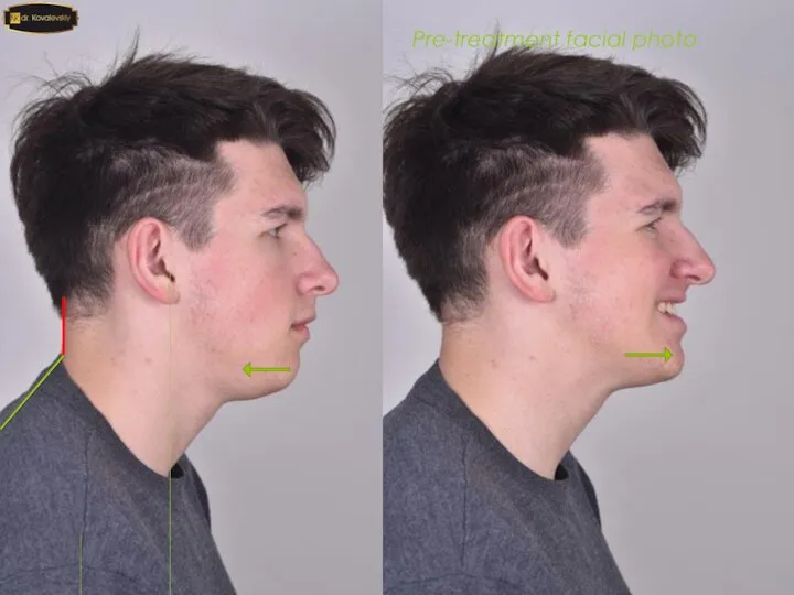 Pre-treatment facial photo