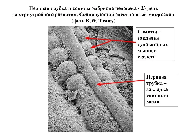 Нервная трубка и сомиты эмбриона человека - 23 день внутриутробного развития. Сканирующий