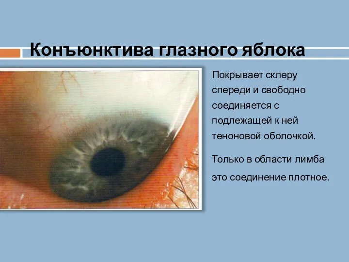 Конъюнктива глазного яблока Покрывает склеру спереди и свободно соединяется с подлежащей к