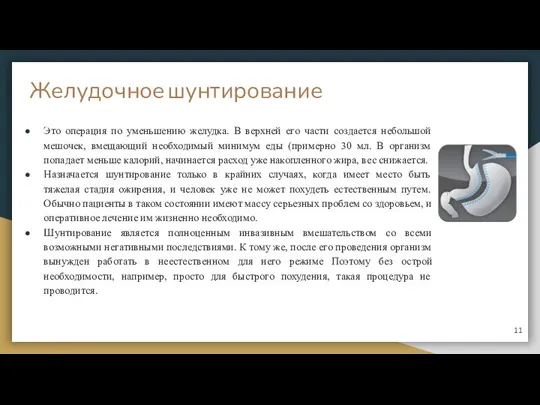 Желудочное шунтирование Это операция по уменьшению желудка. В верхней его части создается