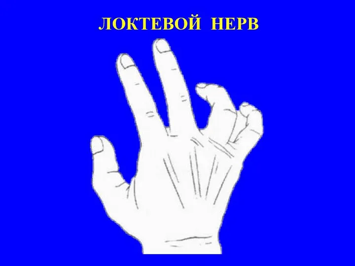 ЛОКТЕВОЙ НЕРВ