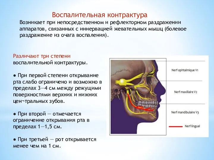 Воспалительная контрактура Возникает при непосредственном и рефлекторном раздражении аппаратов, связанных с иннервацией