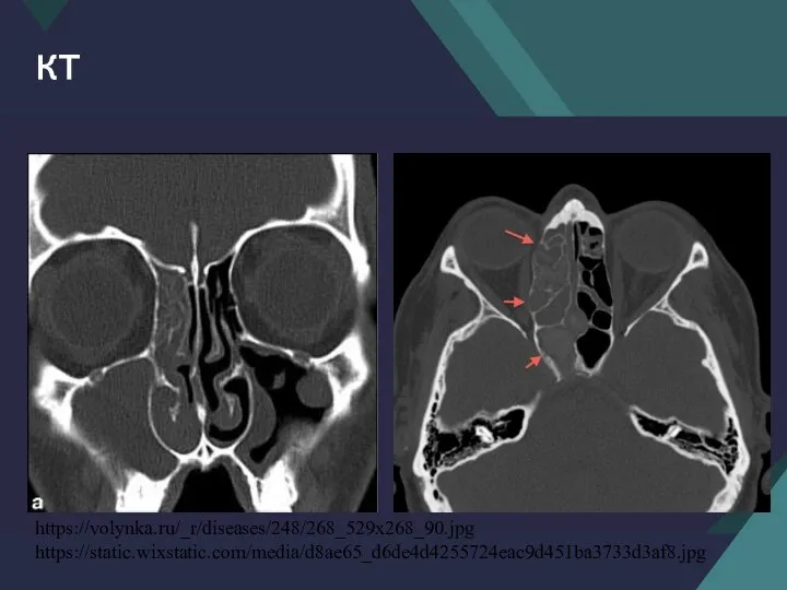 КТ https://volynka.ru/_r/diseases/248/268_529x268_90.jpg https://static.wixstatic.com/media/d8ae65_d6de4d4255724eac9d451ba3733d3af8.jpg