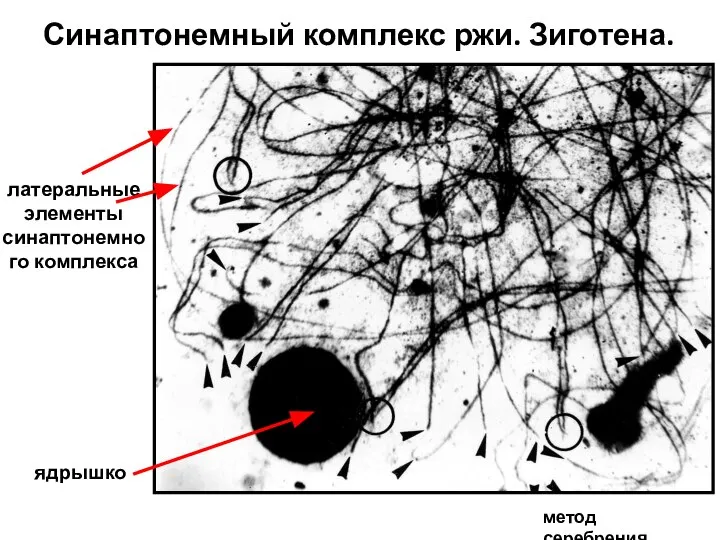 Синаптонемный комплекс ржи. Зиготена. метод серебрения ядрышко латеральные элементы синаптонемного комплекса