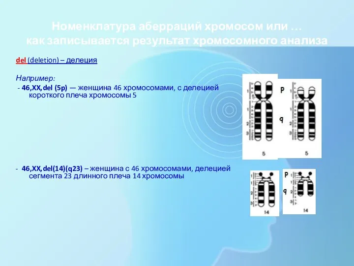 Номенклатура аберраций хромосом или … как записывается результат хромосомного анализа del (deletion)