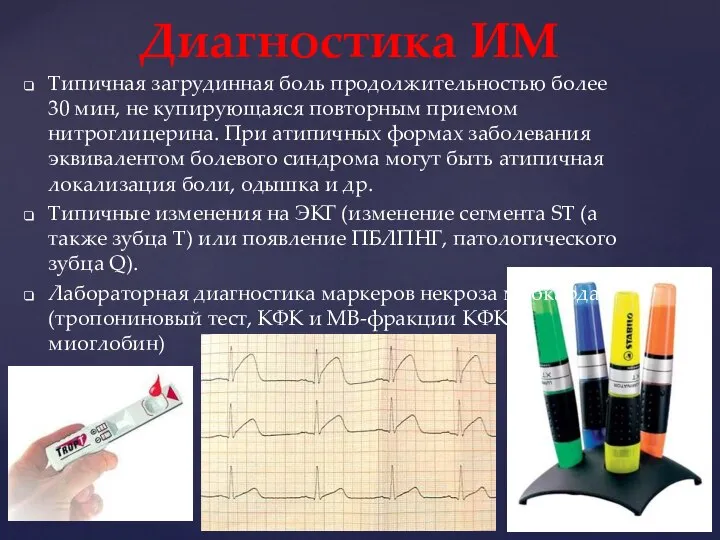 Типичная загрудинная боль продолжительностью более 30 мин, не купирующаяся повторным приемом нитроглицерина.