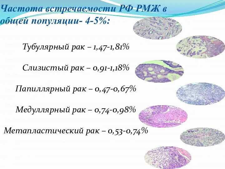 Частота встречаемости РФ РМЖ в общей популяции- 4-5%: Тубулярный рак – 1,47-1,81%