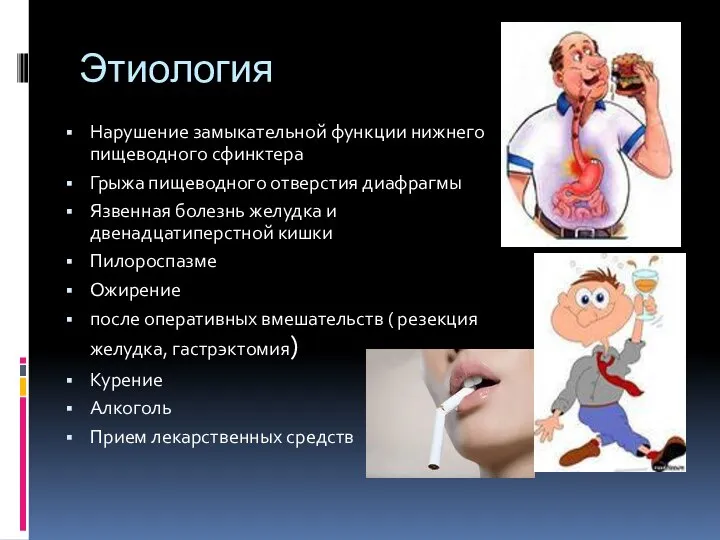 Этиология Нарушение замыкательной функции нижнего пищеводного сфинктера Грыжа пищеводного отверстия диафрагмы Язвенная