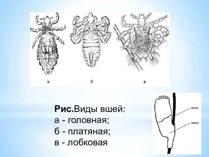 Рис.Виды вшей: а - головная; б - платяная; в - лобковая