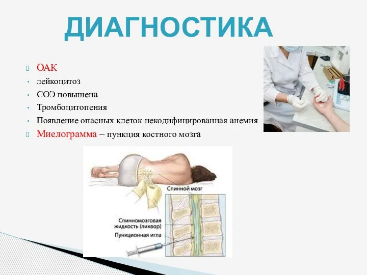 ОАК лейкоцитоз СОЭ повышена Тромбоцитопения Появление опасных клеток некодифицированная анемия Миелограмма – пункция костного мозга ДИАГНОСТИКА