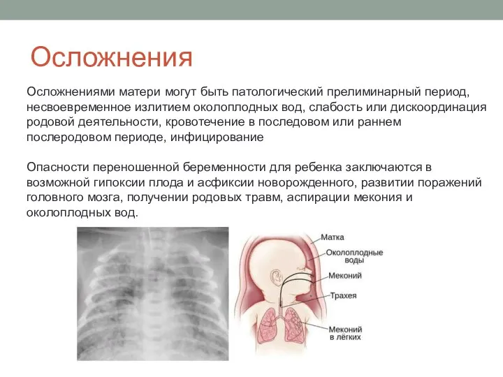 Осложнения Осложнениями матери могут быть патологический прелиминарный период, несвоевременное излитием околоплодных вод,