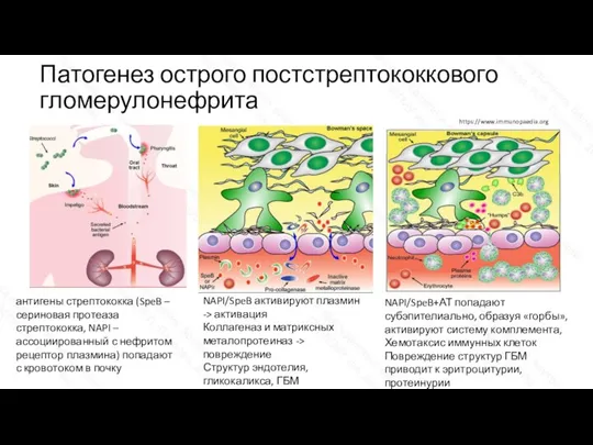 Патогенез острого постстрептококкового гломерулонефрита антигены стрептококка (SpeB – сериновая протеаза стрептококка, NAPI