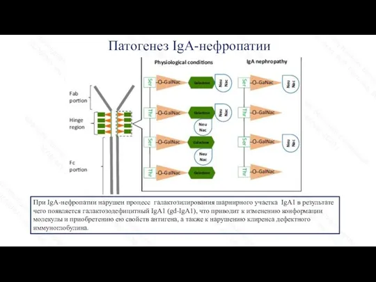 Патогенез IgA-нефропатии При IgA-нефропатии нарушен процесс галактозилирования шарнирного участка IgA1 в результате