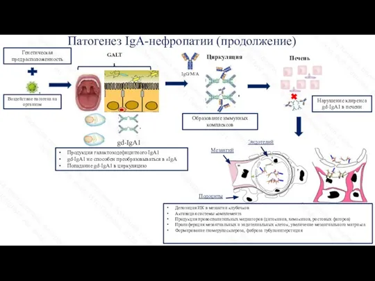 Патогенез IgA-нефропатии (продолжение) gd-IgA1 Генетическая предрасположенность Воздействие патогена на организм Продукция галактозодефицитного
