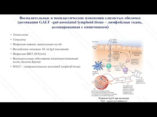 Воспалительные и неопластические изменения слизистых оболочек (активация GALT –gut-associated lymphoid tissue –