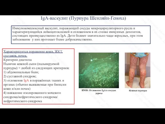 IgA-васкулит (Пурпура Шенляйн-Геноха) Иммунокомплексный васкулит, поражающий сосуды микроциркуляторного русла и характеризующийся лейкоцитоклазией