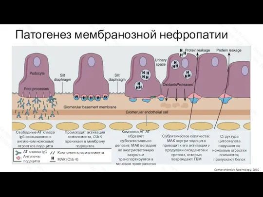 Патогенез мембранозной нефропатии Comprehensive Nephrology, 2010 АТ класса IgG Антигены подоцита Компоненты