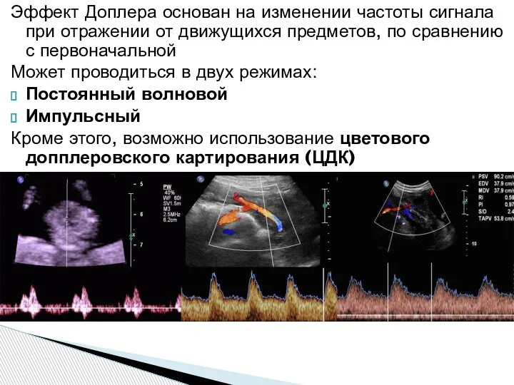 Эффект Доплера основан на изменении частоты сигнала при отражении от движущихся предметов,