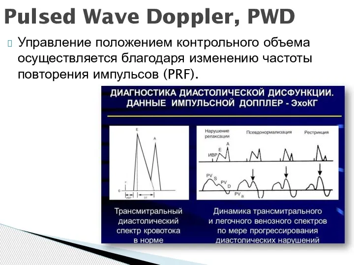 Управление положением контрольного объема осуществляется благодаря изменению частоты повторения импульсов (PRF). Pulsed Wave Doppler, PWD