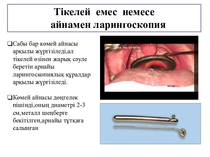 Сабы бар көмей айнасы арқылы жүргізіледі,ал тікелей өзінен жарық сәуле беретін арнайы