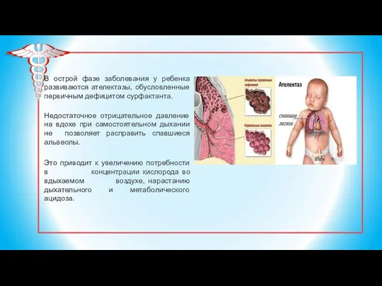 В острой фазе заболевания у ребенка развиваются ателектазы, обусловленные первичным дефицитом сурфактанта.