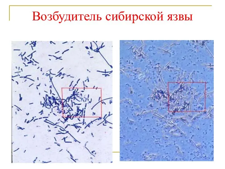 Возбудитель сибирской язвы