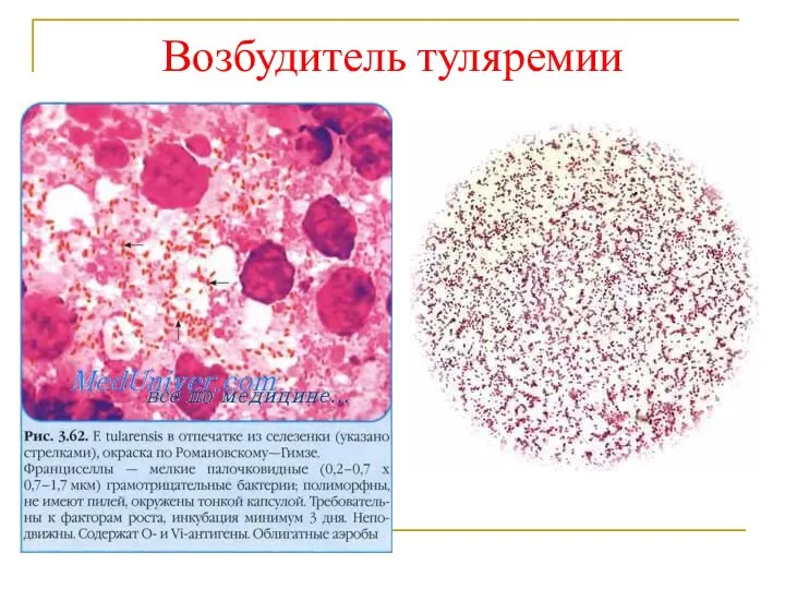 Возбудитель туляремии