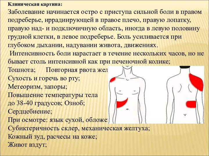 Клиническая картина: Заболевание начинается остро с приступа сильной боли в правом подреберье,