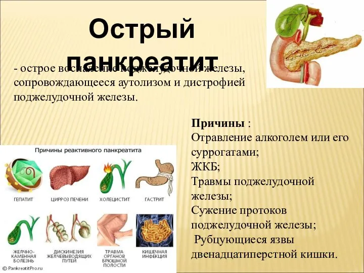 Острый панкреатит - острое воспаление поджелудочной железы, сопровождающееся аутолизом и дистрофией поджелудочной