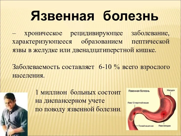 Язвенная болезнь – хроническое рецидивирующее заболевание, характеризующееся образованием пептической язвы в желудке